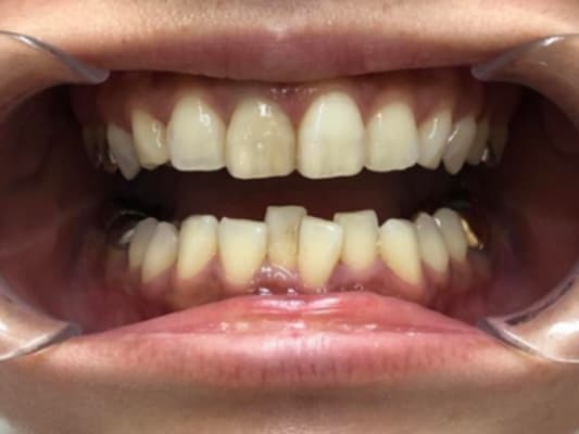 審美歯科のオンライン診断用写真